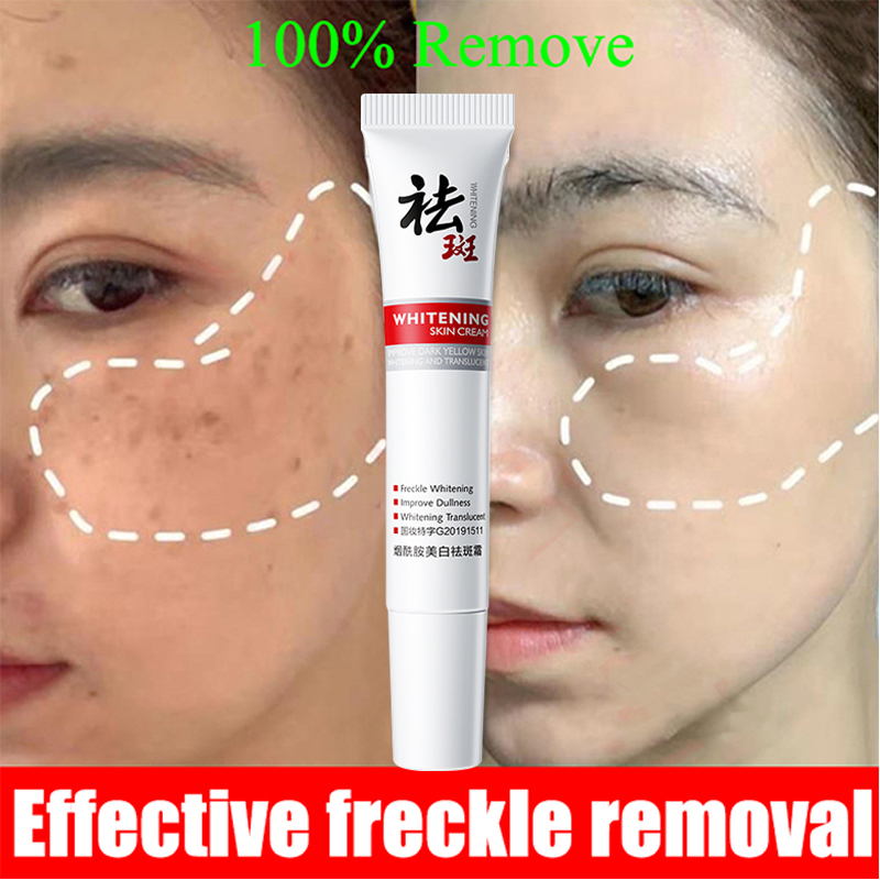 ZHIDUOWhitening Freckle Cream Removal Melasma Anti Aging Serum Pekas