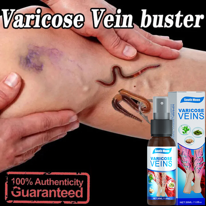 Effectivesouth Moon Varicose Vein Spray Ml Smoothes Bulging