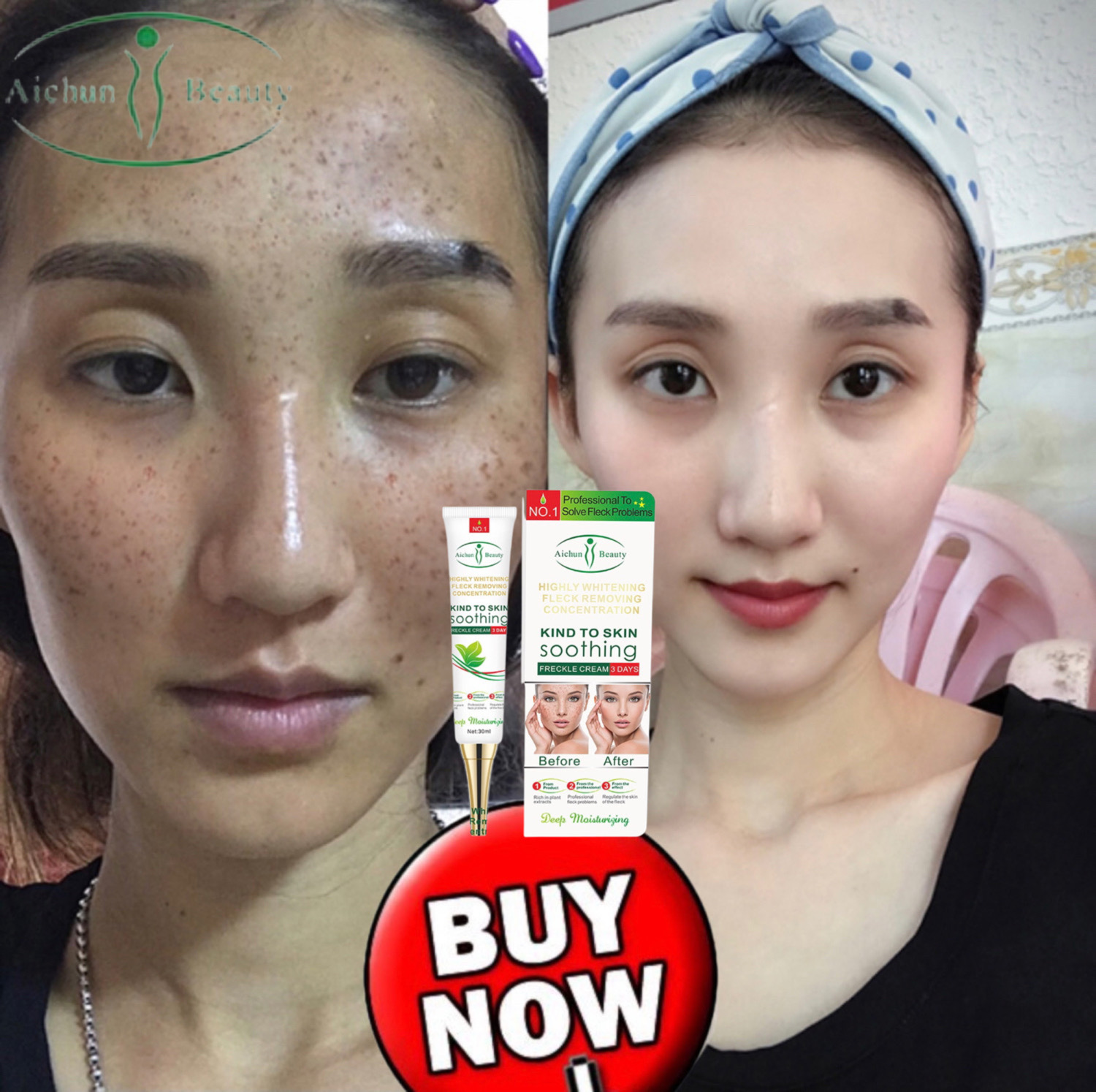 Aichun Creme De Clareamento Eficaz G Remover Melasma Acne Mancha