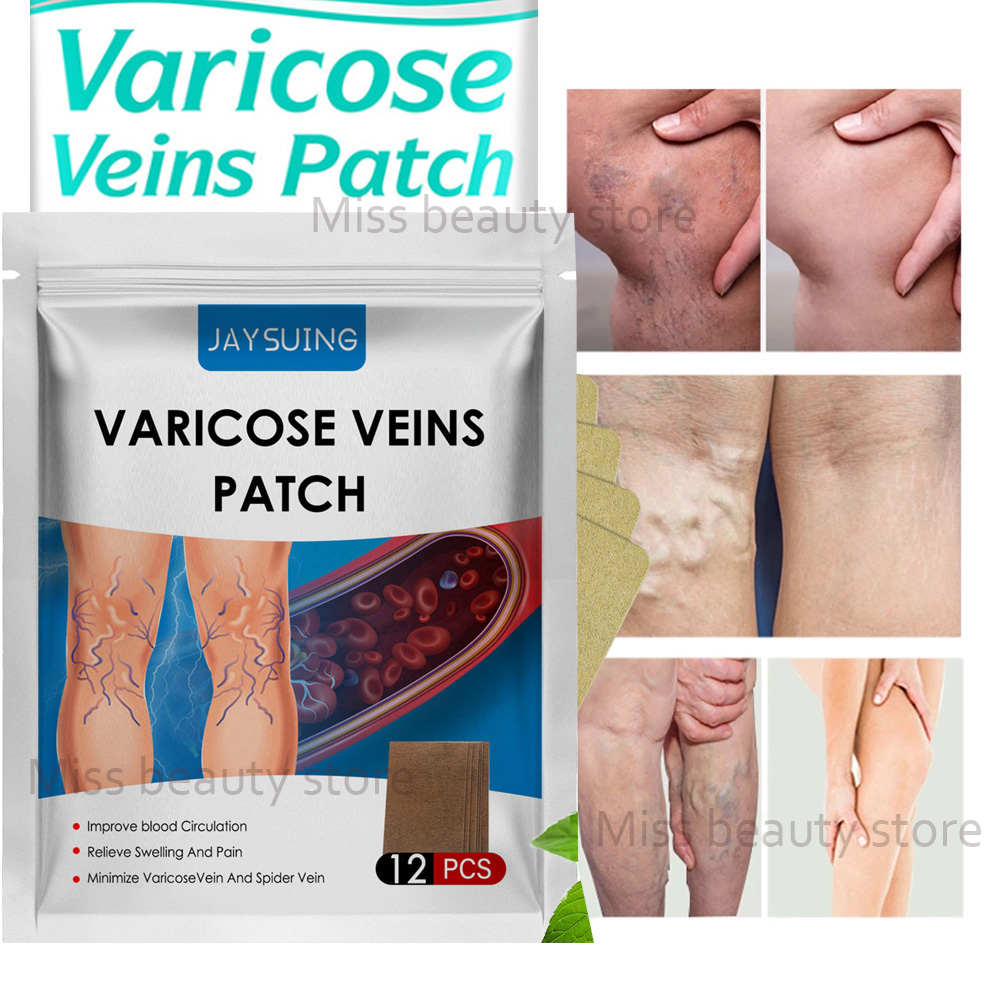 12PCS Varicose Veins Plaster Natural Varicouse Veins Patch Original