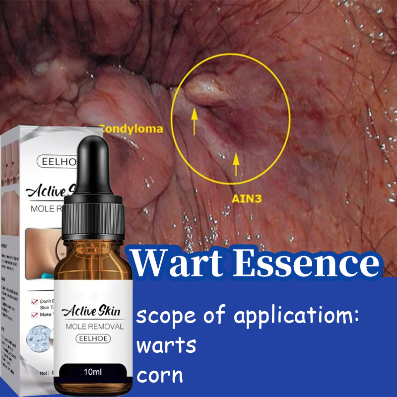 Warts Removal Serum Warts Remover Original Oil Ml Wart Removing