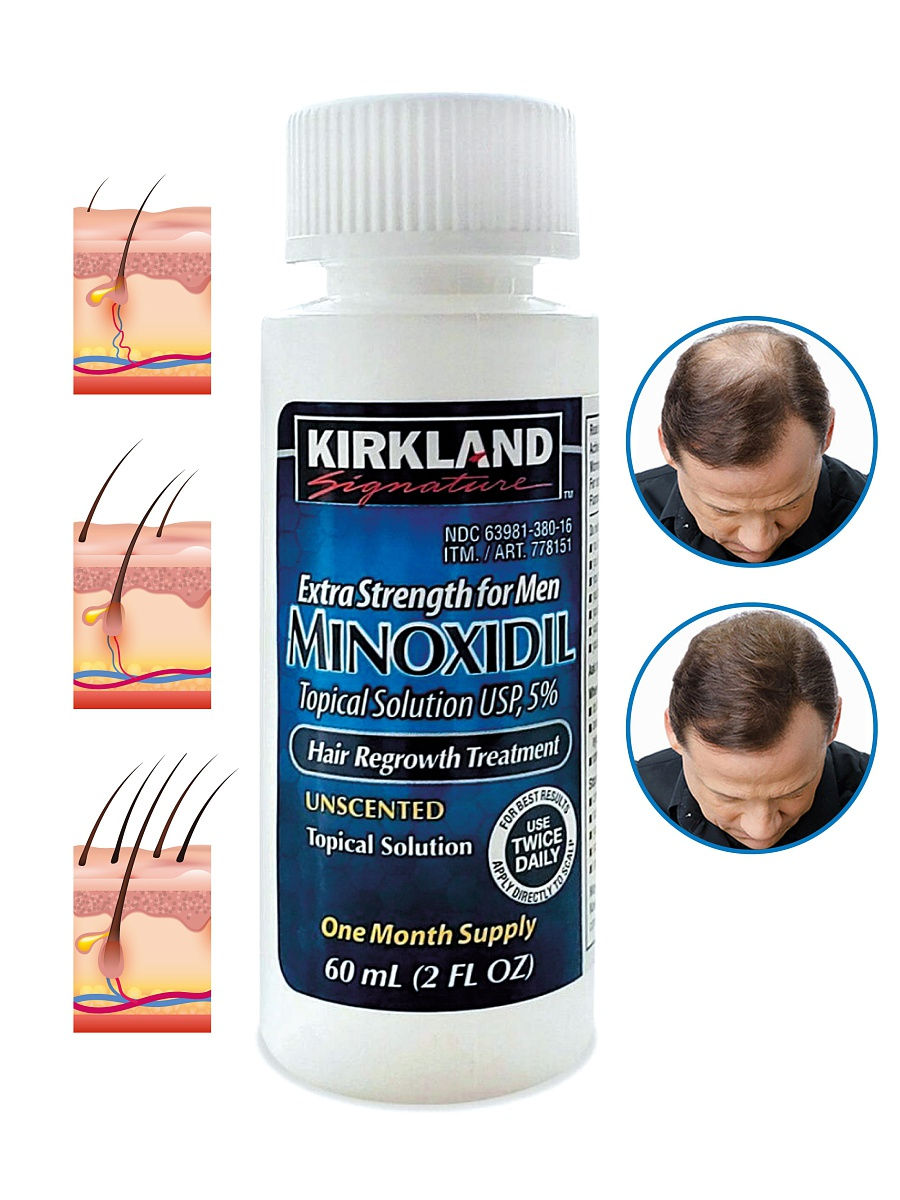 Kirkland Signature Minoxidil Topical Solution For Men SOLD PER PICE