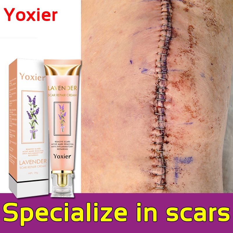 Yoxier Acne Scars Cream 20gAcne Scars Scar Removal Gel Scar Repair