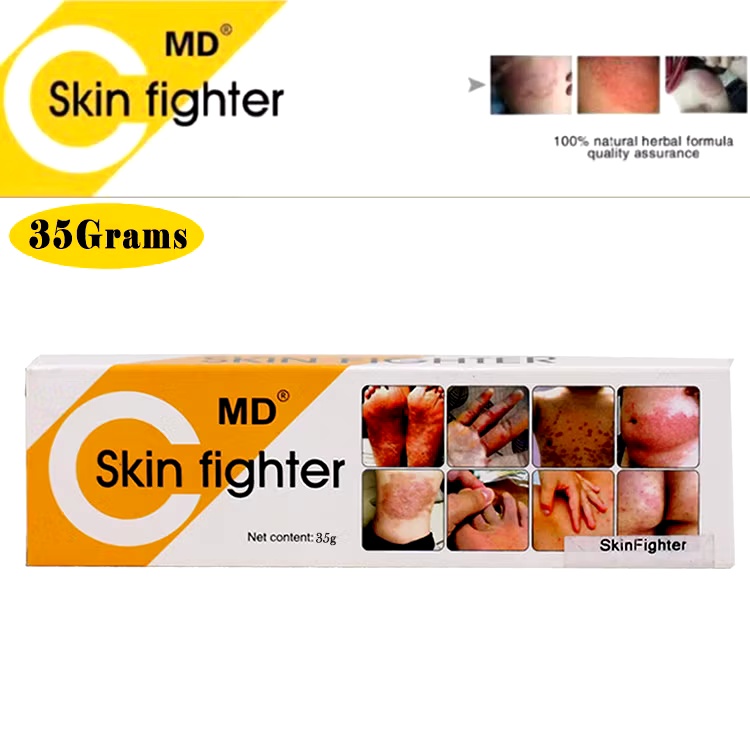 Great Love Piece Skin Fighter Cream For Skin Allergies Or Fungis