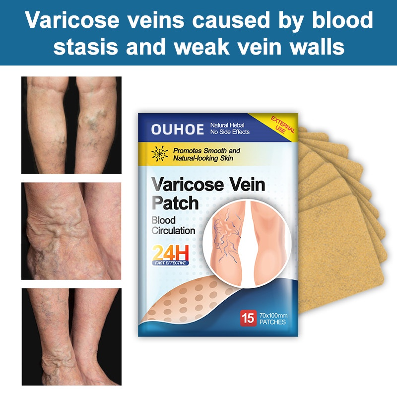 Pcs Varicose Vein Patch Natural Varicose Veins Remover Effective