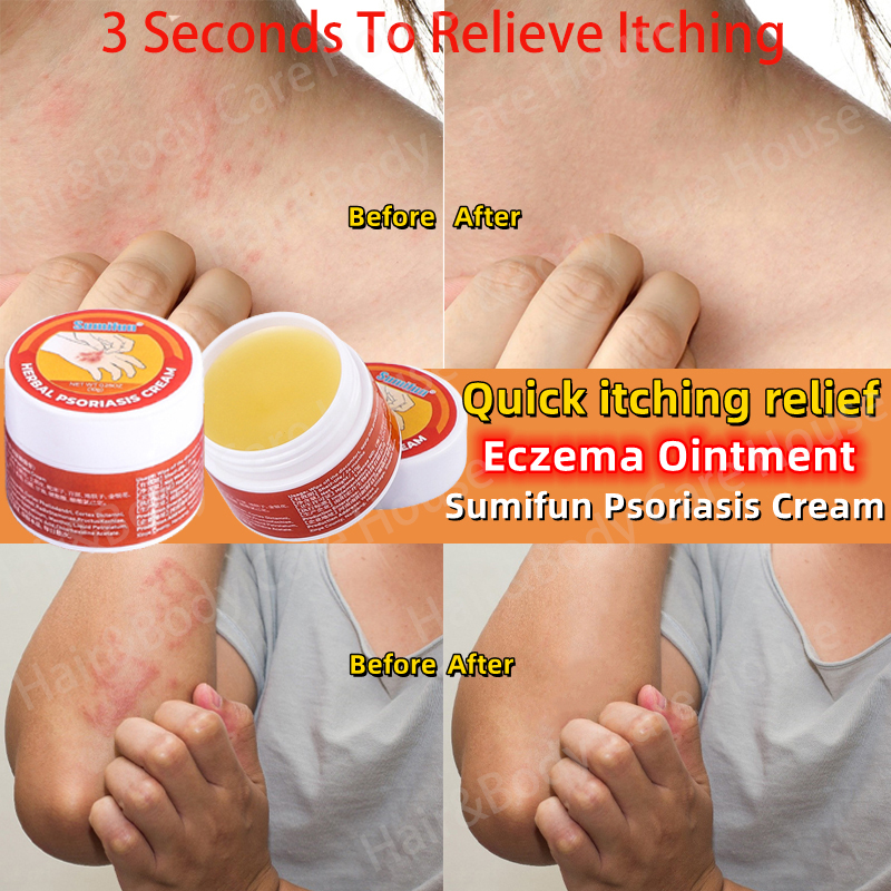 Sumifun Skin Disease Ointment Original Eczema Cream Antibacterial Cream