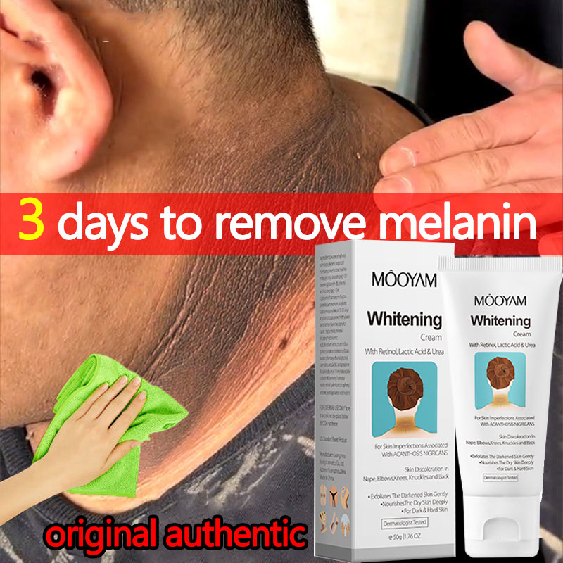 Acanthosis Nigricans Cream MOOYAM Results In 3 Days Whitening Cream