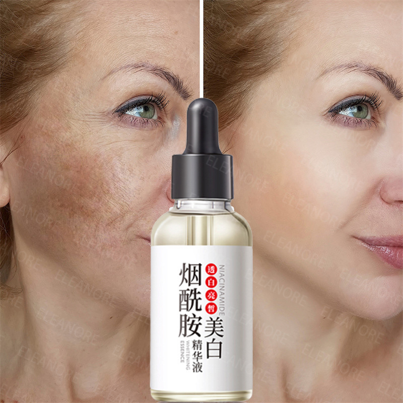 Niacinamide Anti Melasma Serum Effective Freckle Removal Whitening