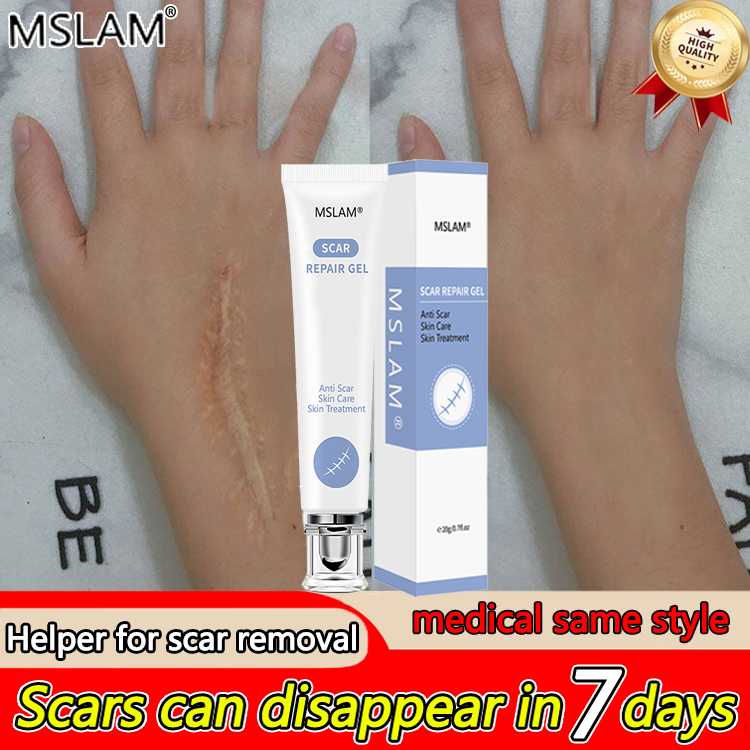 Medical Helper To Eliminate Scars In 7 Days MSLAM Scar Removal Cream