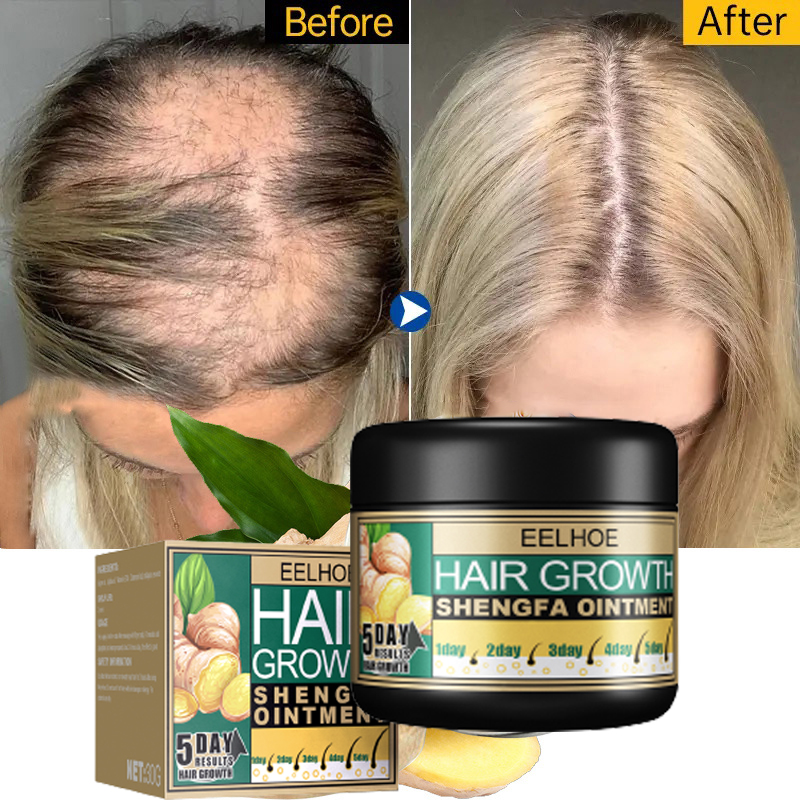 5 Days Ginger Hair Growth Care 30g Eelhoe Ointment Hair Fast Regrowth