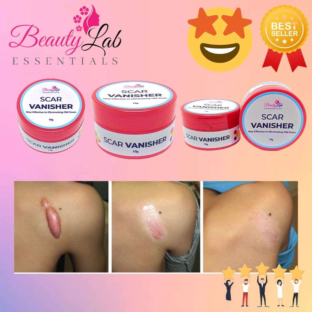 Eauty Essentials Scar Removal Cream 10g Scar Vanisher Remove All