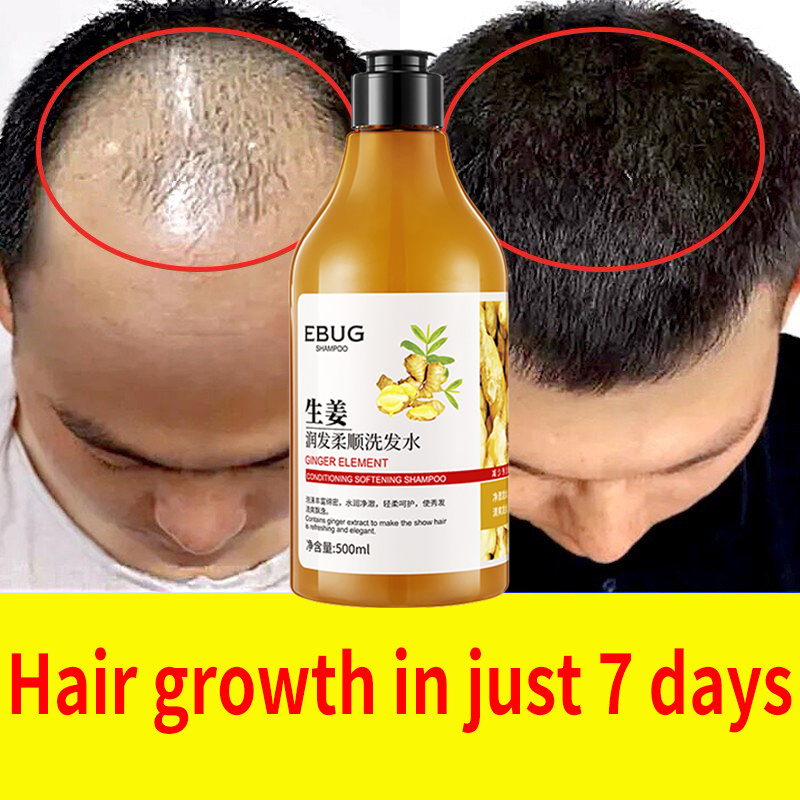 Original Natural Ginger Shampoo For Hair Loss Herbal Ginger