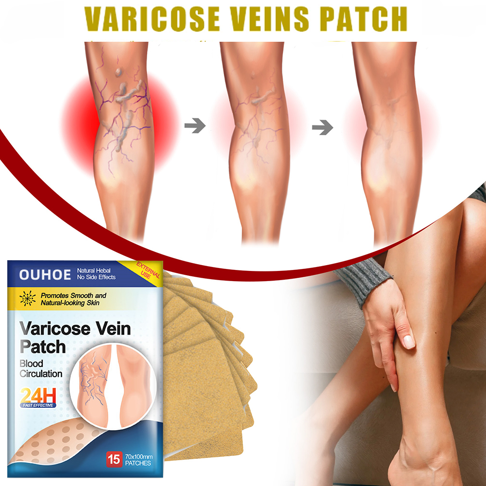 15PCS Natural Varicouse Veins Patch Original Herbal Varicose Veins