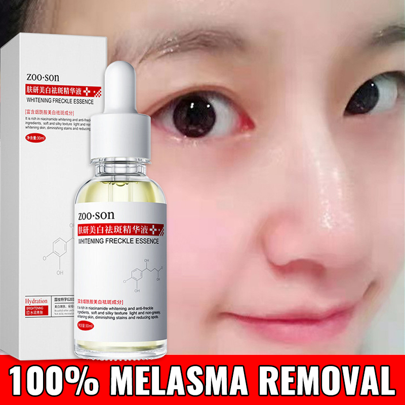 Niacinamide Anti Melasma Serum Melasma Remover From Japan The United