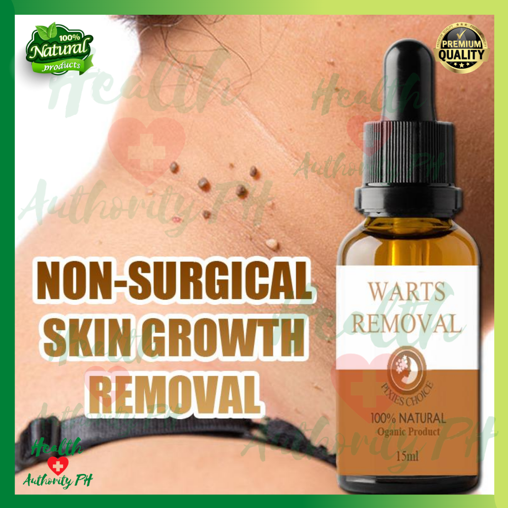 Best Seller 100 Original Pure Organic Warts Remover And Mole Remover