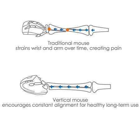 iFlashDeal เมาส์แนวตั้งแก้อาการปวดข้อมือเม้าส์ไร้สาย VERTICAL เม้าส์ ERGONOMIC เกมลวด MICE-สนามบินนานาชาติ Vertical Mouse