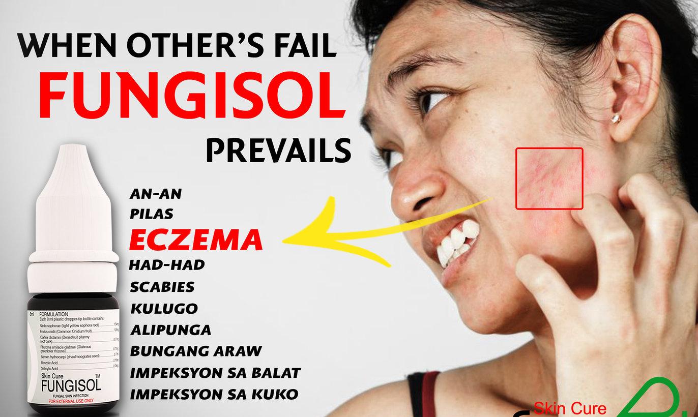 FUNGISOL 4ML ANTIFUNGAL SOLUTION 1 BOTTLE Review And Price