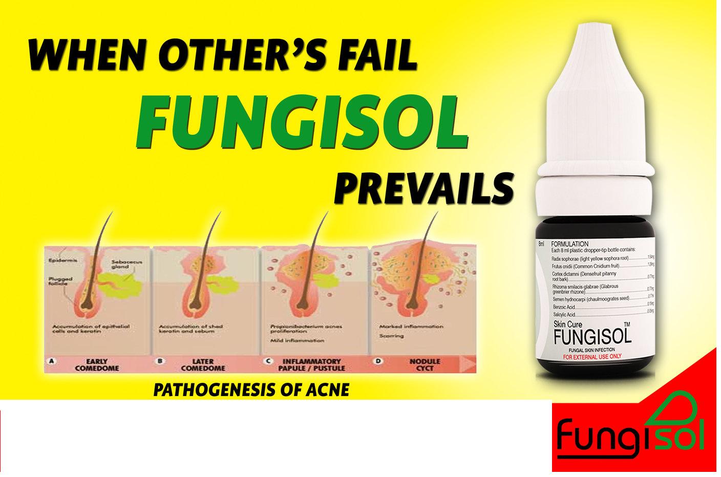 FUNGISOL 4ML ANTIFUNGAL SOLUTION 1 BOTTLE