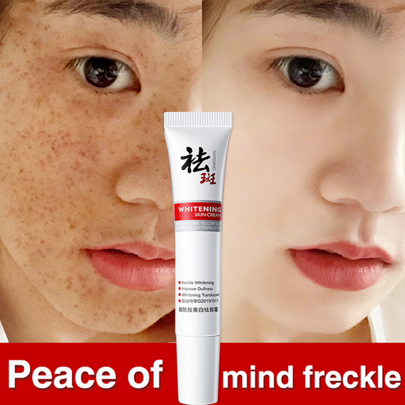 Genuine Freckle Removal Whitening Cream Melasma And Pekas Remover Original Pekas Remover Cream