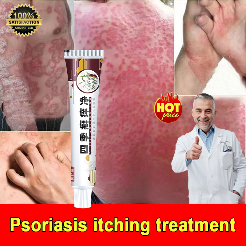 Ringworm Removal Ointment Psoriasis Ointment Eczema Treatment Cream ...