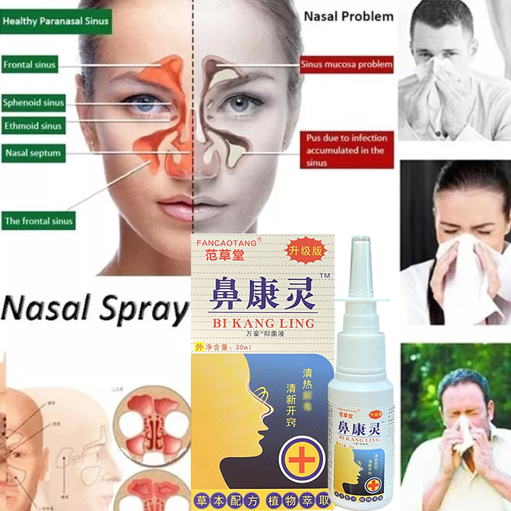[Doctor Nasal Sprays Chronic Rhinitis sinusitis nasal