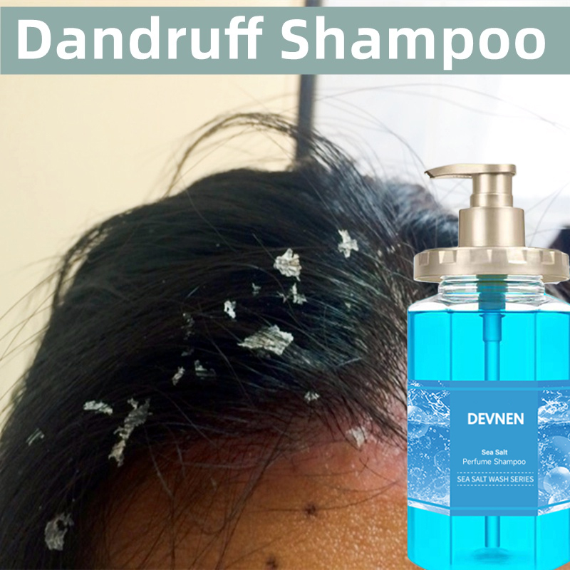 Sea Salt Anti Dandruff Shampoo 500ML For Dandruff and Scalp Treatment