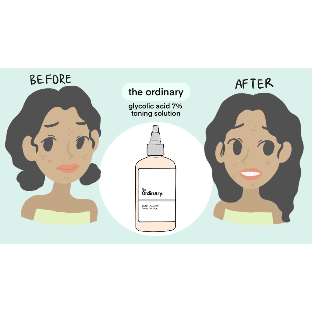 The Ordinary Glycolic Acid 7% Toning Solution 240ml toner skincare beauty  Oily skin | Lazada PH