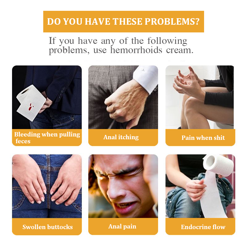 Idun Natural Chinese Medicine Hemorrhoid Cream Anal Fissure Treatment