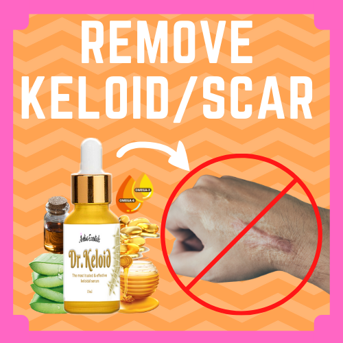 Dr. Keloid Keloid treatment ( Keloid scar remover effective / Keloid
