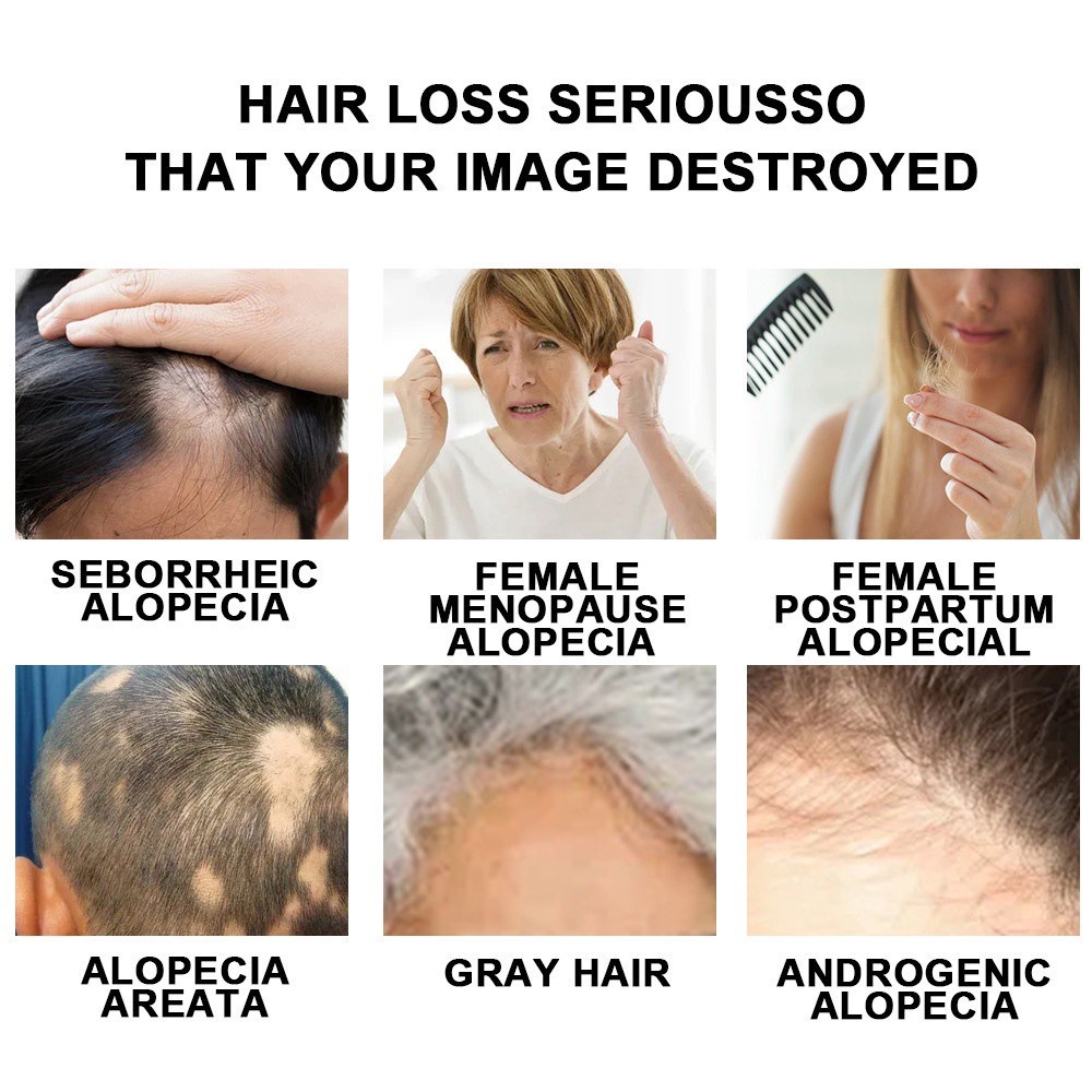 Japanese Ginger Shampoo AntiDandruff Shampoo Anti Hair Loss Shampoo