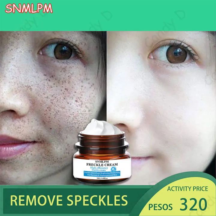 snmlpm freckle cream