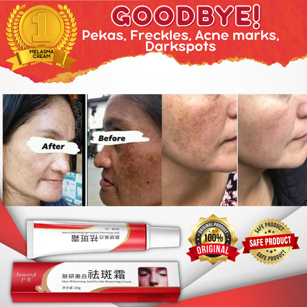 100 Effective And Original Whitening Freckle Cream Remover Original Pekas Remover Melasma Acne 5208