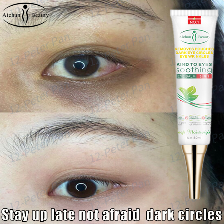 under eye cream to remove dark circles
