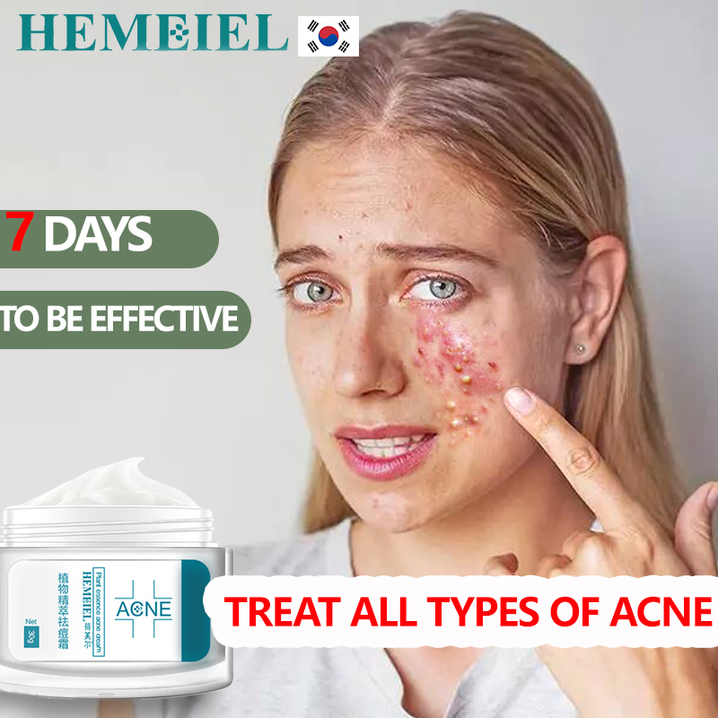 HEMEIEL Pimple Marks Remover/Pimples Eraser Quick Fx/Benzac Benzoyl ...