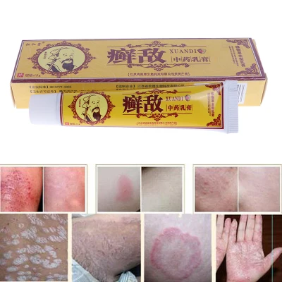 【sjqgqx】Psoriasis Eczema Cream Antifungal Antibacterial Itchy Cream Skin Care