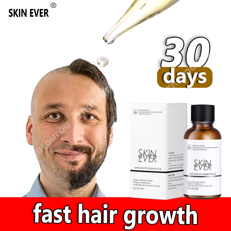 SKIN EVER hair growth essential oil made with plant nutrients Healthy and  protects your scalp Hair Growth Fast Solve hair loss Hair care for men Hair  care treatment Hair Essential Oil for