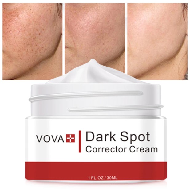 {MS} VOVA 30ML Face Cream Dark Spots Removal Cream Whiten and Brighten