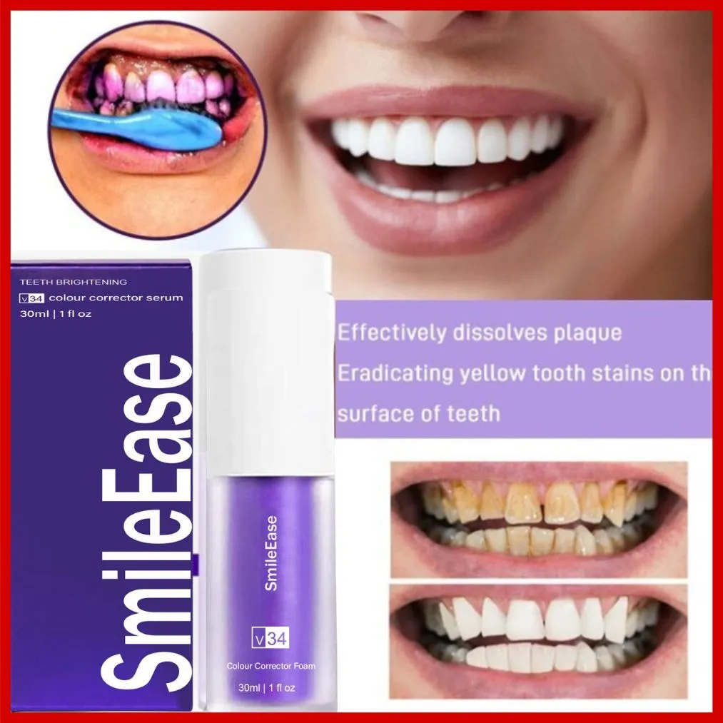 Smile Ease V34 toothpaste violet toothpaste Teeth whitening stain ...