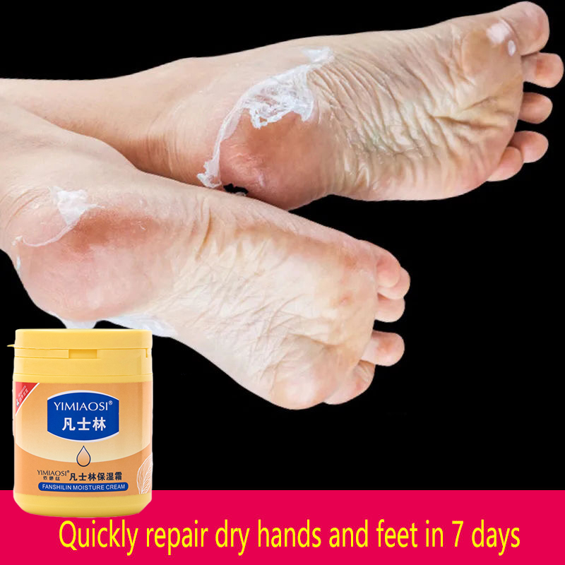 170g Vaseline Moisturizing Cream Original Foot Cream For Dry and Crack Heels Repairing Rough