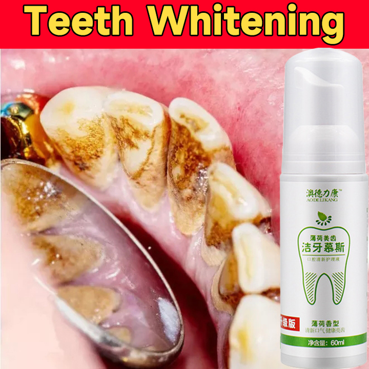100ML Teeth Whitening Mousse Foam Toothpaste Teeth Cleaning Mousse