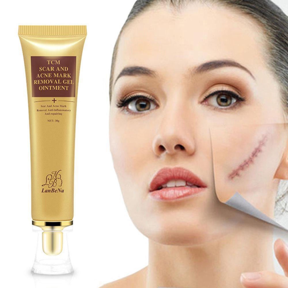 ORIGINAL TCM Scar Removal Cream Acne Treatment Skin Repair for Face Ear