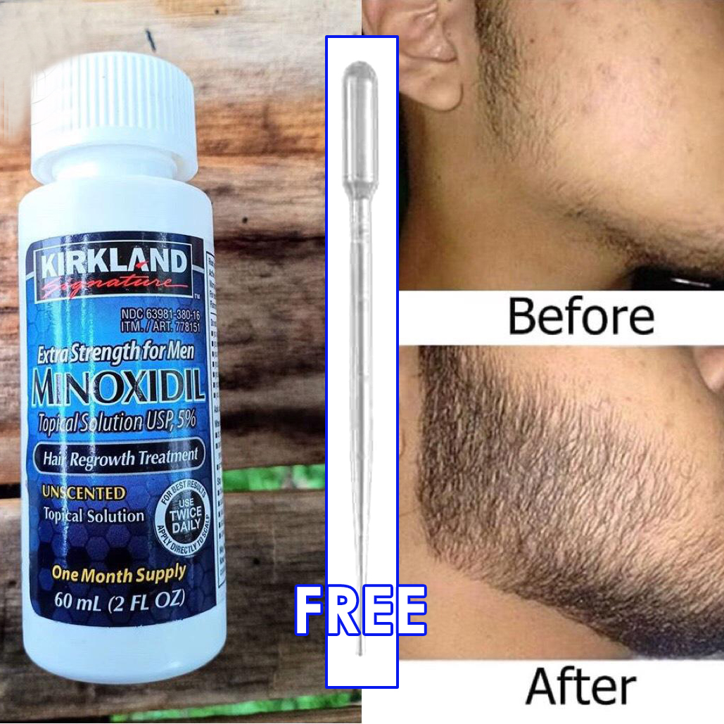 MINOXIDIL TOPICAL) Kirkland Minoxidil 5% Extra Strength Hair for 60ml (minoxidil fast delivery) | Lazada PH