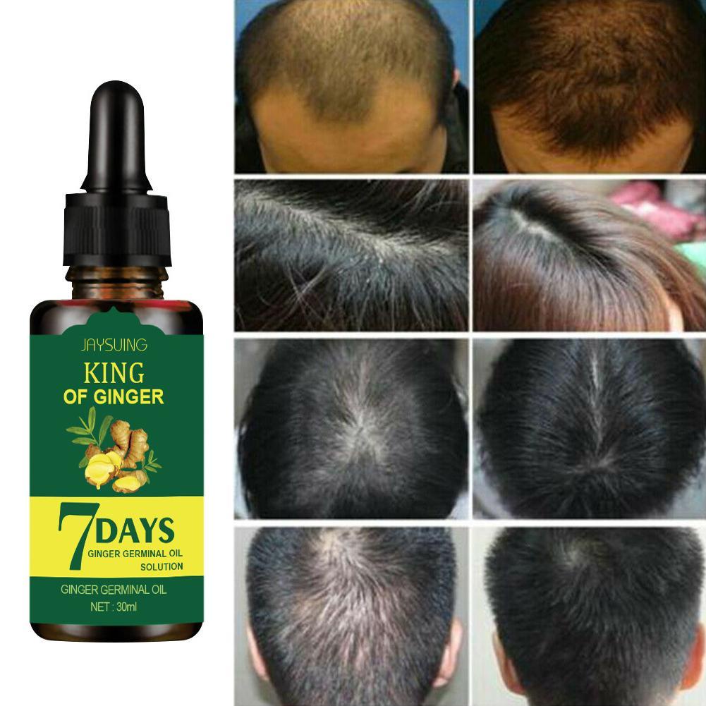 Ginger King Hair Nutrient Solution Natural And Fast Treatment Of Hair 