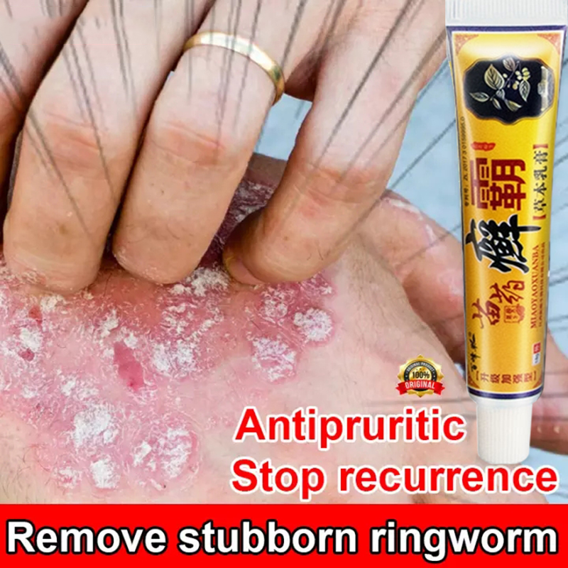 psoriasis-eczema-treatment-anti-bacterial-skin-fungus-cream-regenerate