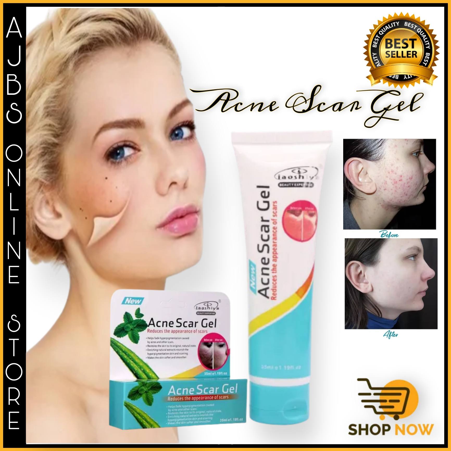 Newest And Effective Acne Scar Gel Remove Scar Acne Fade Stretch Marks Control Oil Moisturize