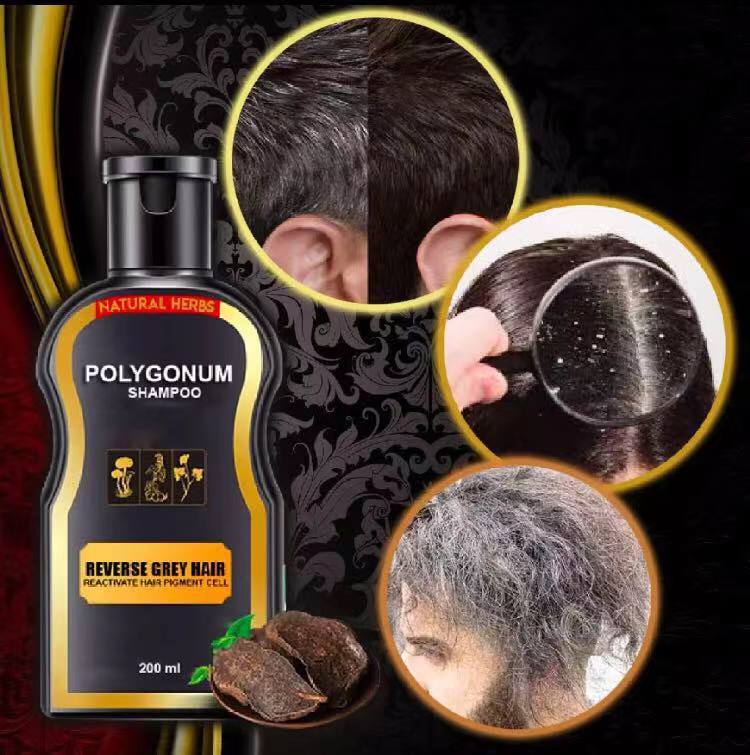 Original Natural Herbs Reverse Grey Hair Darkening Natural Polygonum  Shampoo 200ml | Lazada PH