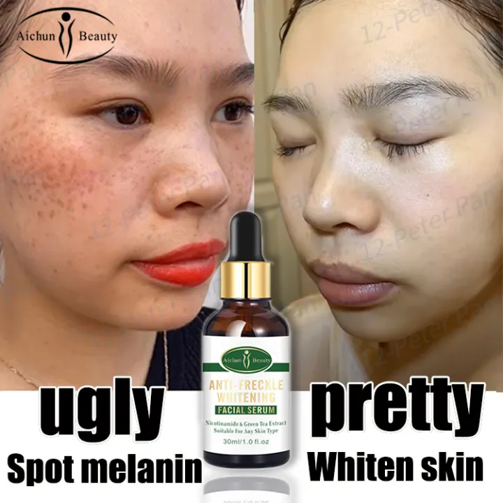 effective wrinkle remover