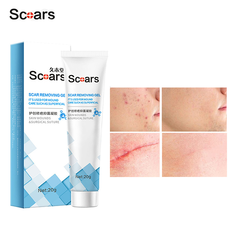 20g scar remover used for old scars on body scars scars burns and ...