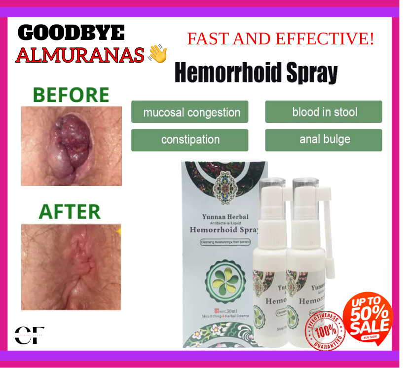 BEST SELLER original HERBAL Hemorrhoids Spray 100 Guaranteed safe and