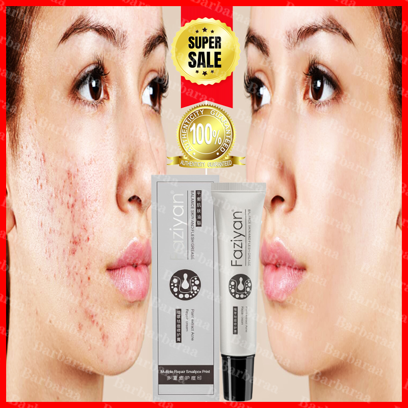 Herbal Acne Removal Gel Acne Solutions Spot Corrector Gel Aloe Vera Mild Cleansing&Repairing